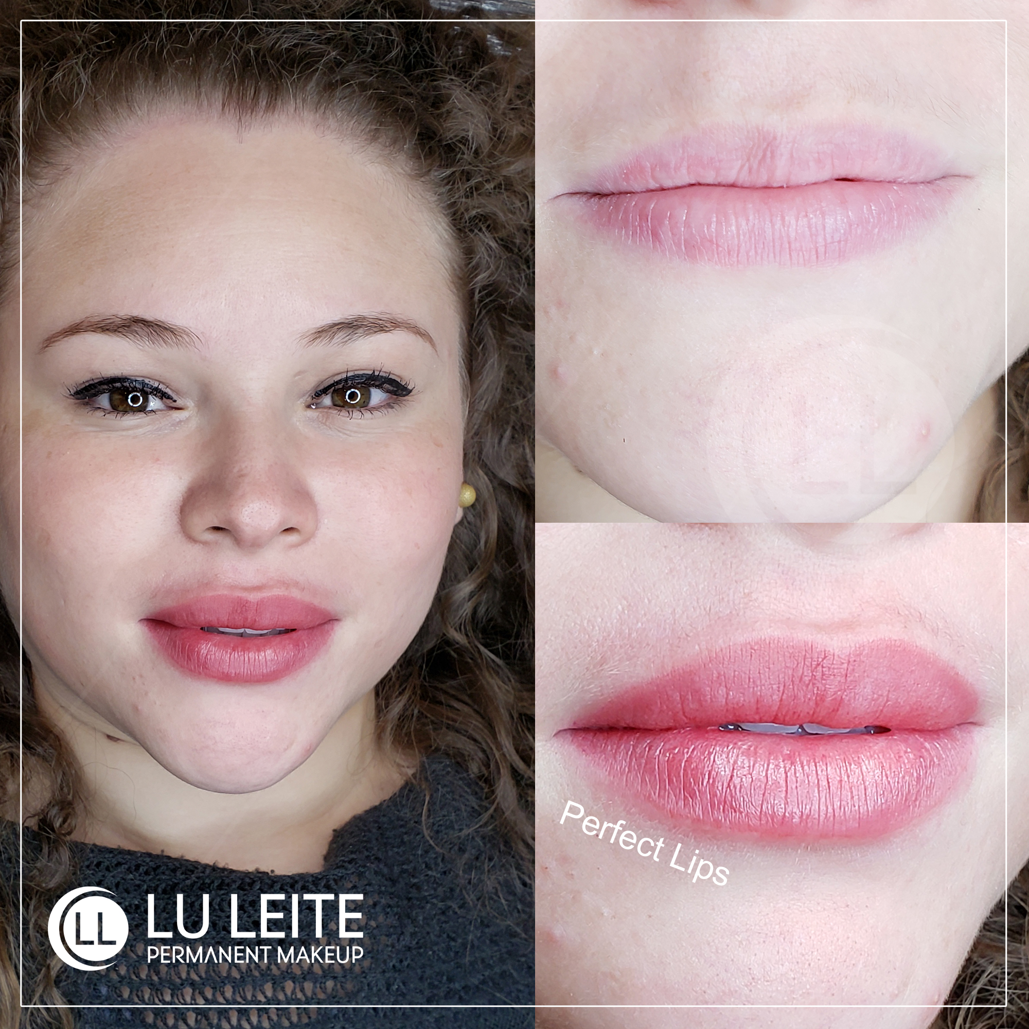Micropigmenta&ccedil;&atilde;o labial