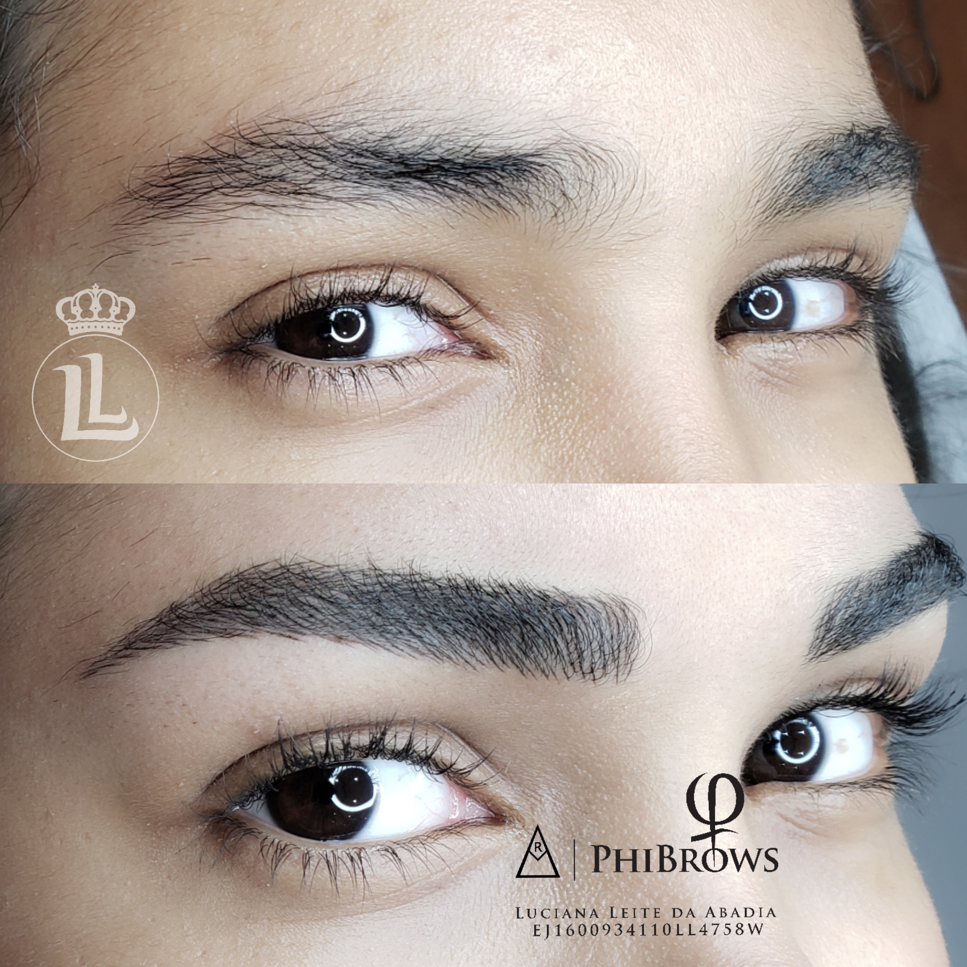 Antes e depois