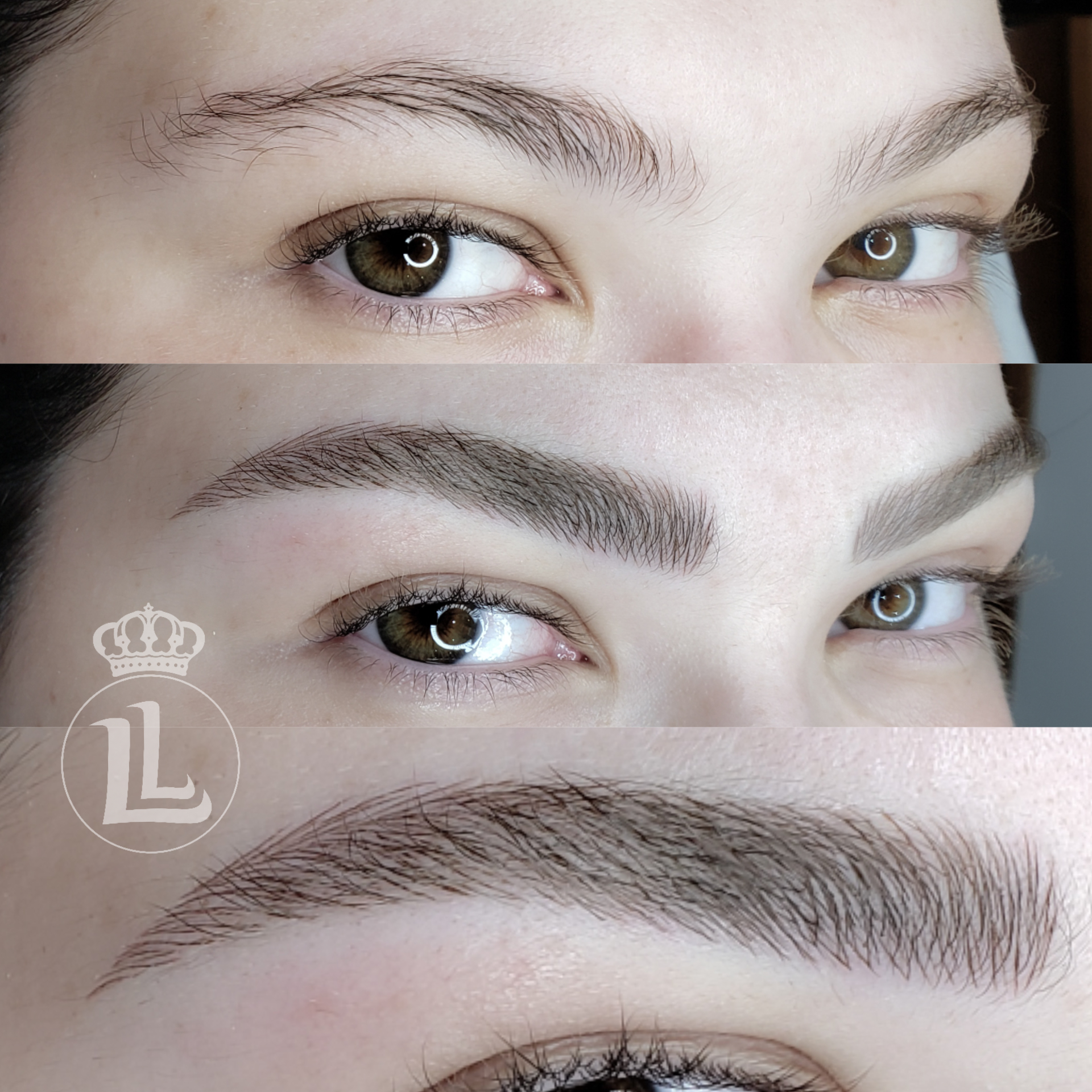 Antes e depois